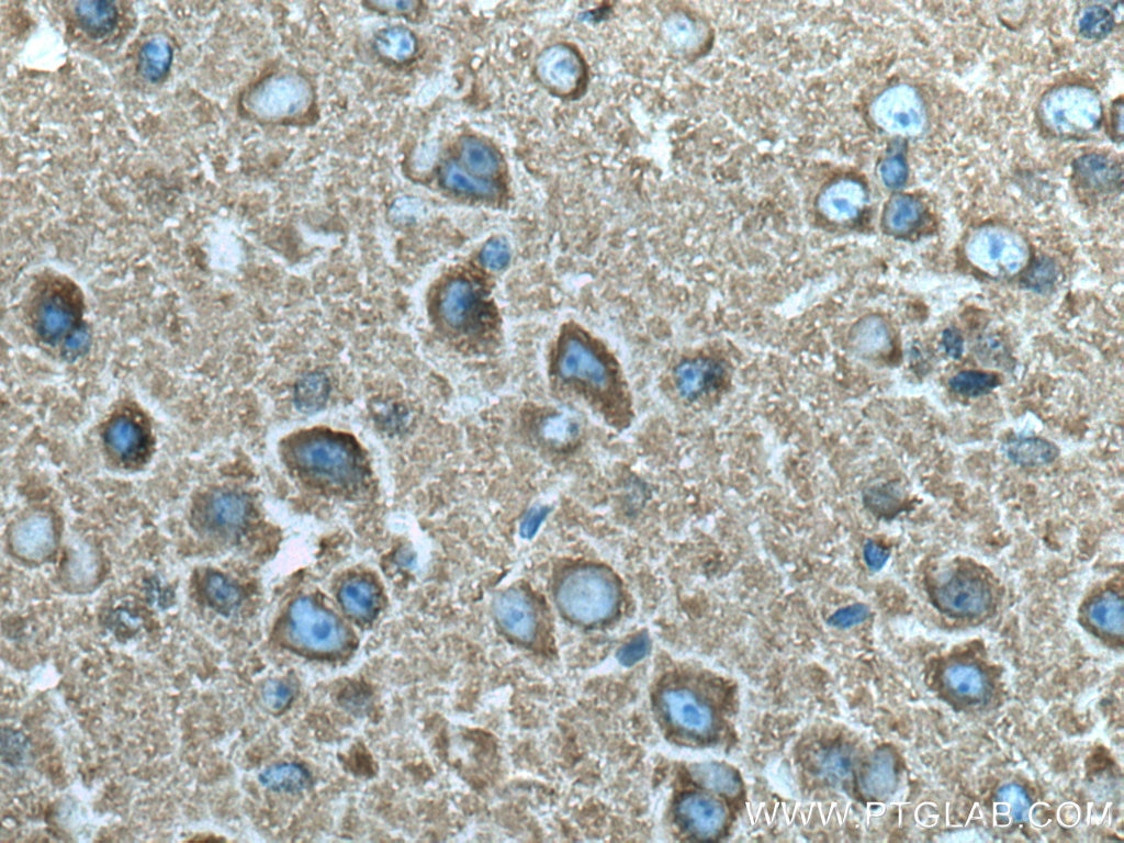 Immunohistochemistry (IHC) staining of mouse brain tissue using Dynamin 1 Polyclonal antibody (18205-1-AP)