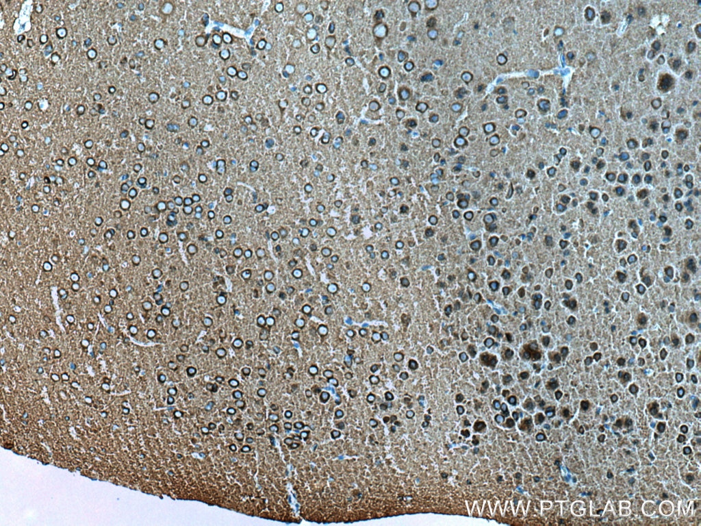 Immunohistochemistry (IHC) staining of rat brain tissue using Dynamin 1 Polyclonal antibody (18205-1-AP)