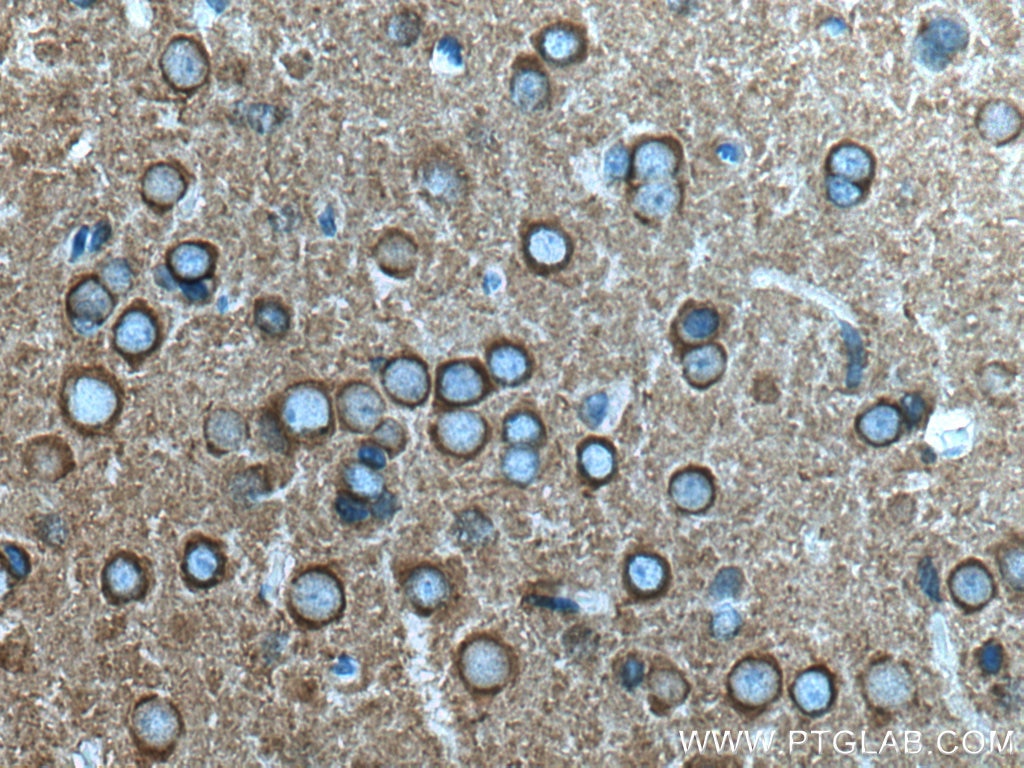 Immunohistochemistry (IHC) staining of rat brain tissue using Dynamin 1 Polyclonal antibody (18205-1-AP)