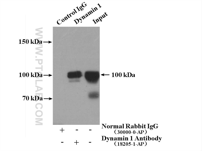 Immunoprecipitation (IP) experiment of mouse brain tissue using Dynamin 1 Polyclonal antibody (18205-1-AP)