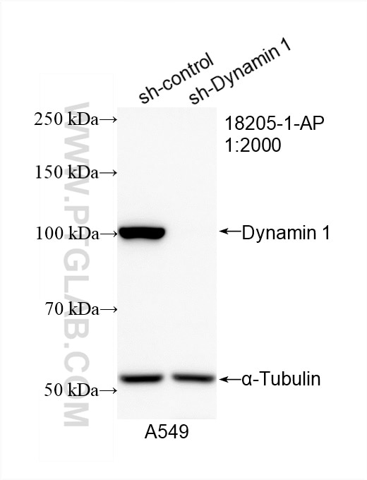 Western Blot (WB) analysis of A549 cells using Dynamin 1 Polyclonal antibody (18205-1-AP)