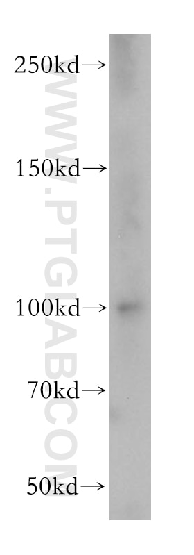 Western Blot (WB) analysis of NIH/3T3 cells using Dynamin 1 Polyclonal antibody (18205-1-AP)