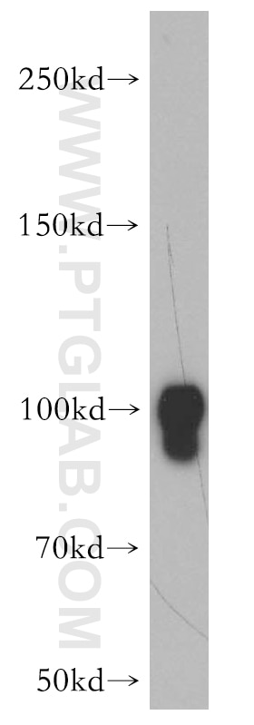 Western Blot (WB) analysis of mouse brain tissue using Dynamin 1 Polyclonal antibody (18205-1-AP)