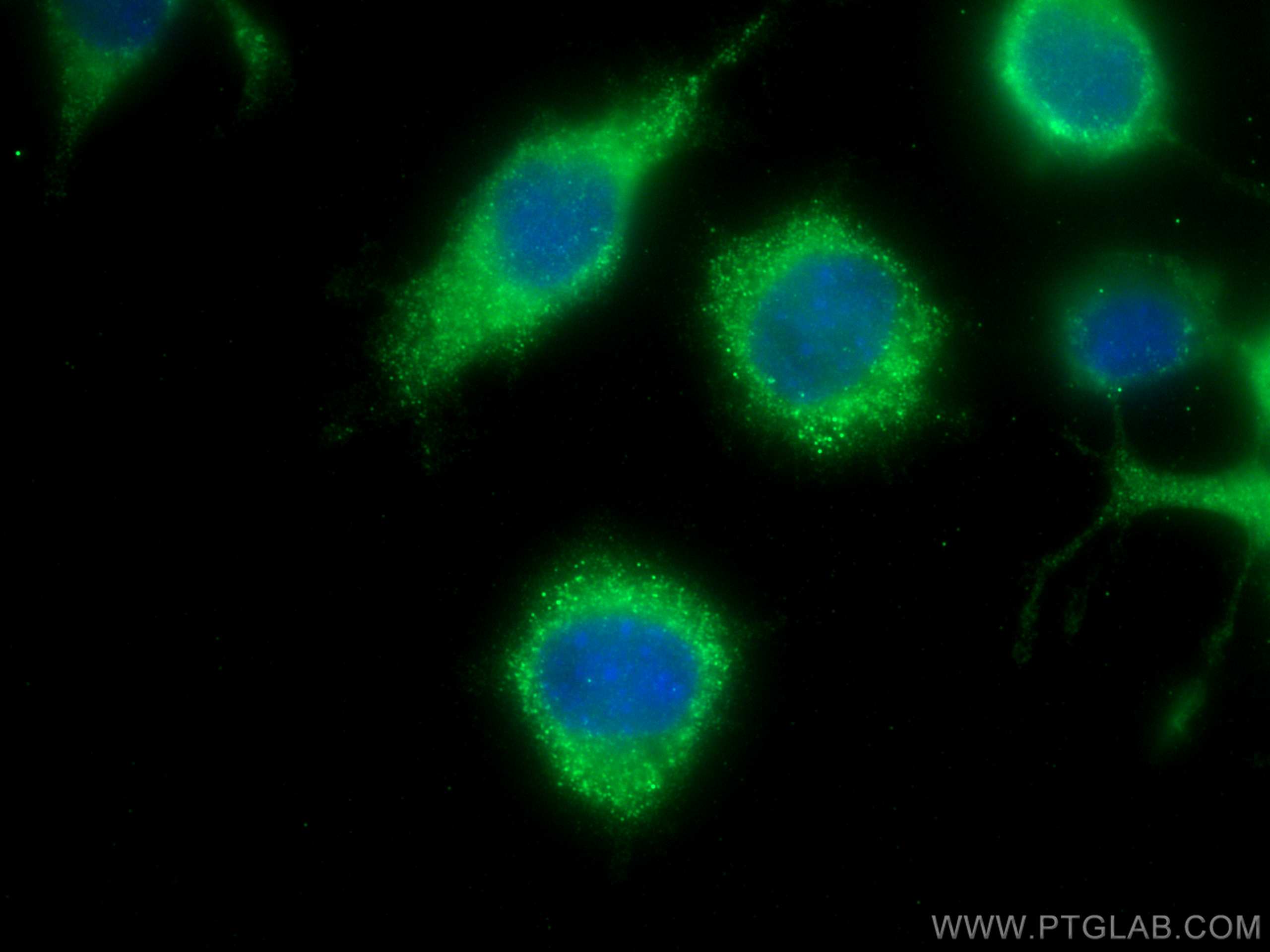 Immunofluorescence (IF) / fluorescent staining of Neuro-2a cells using DNM1 Monoclonal antibody (68009-1-Ig)