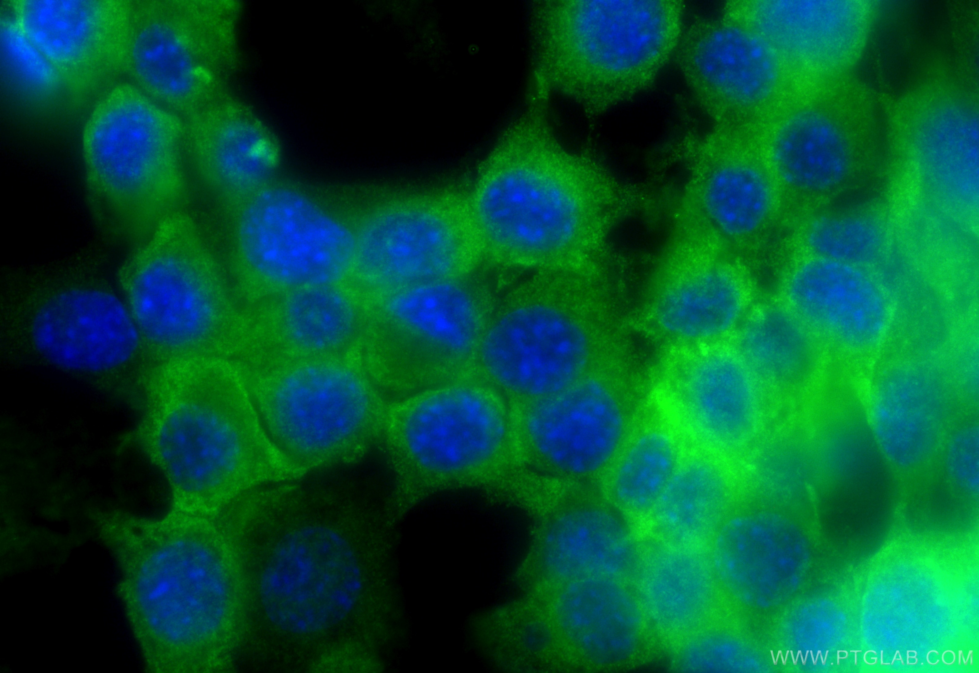 Immunofluorescence (IF) / fluorescent staining of Neuro-2a cells using DNM1 Monoclonal antibody (68009-1-Ig)