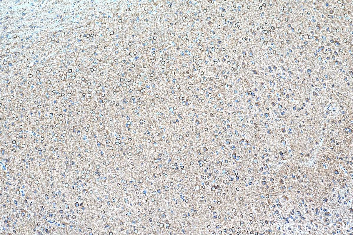 Immunohistochemistry (IHC) staining of rat brain tissue using DNM1 Monoclonal antibody (68009-1-Ig)