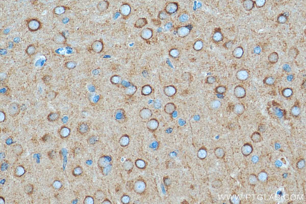 Immunohistochemistry (IHC) staining of rat brain tissue using DNM1 Monoclonal antibody (68009-1-Ig)