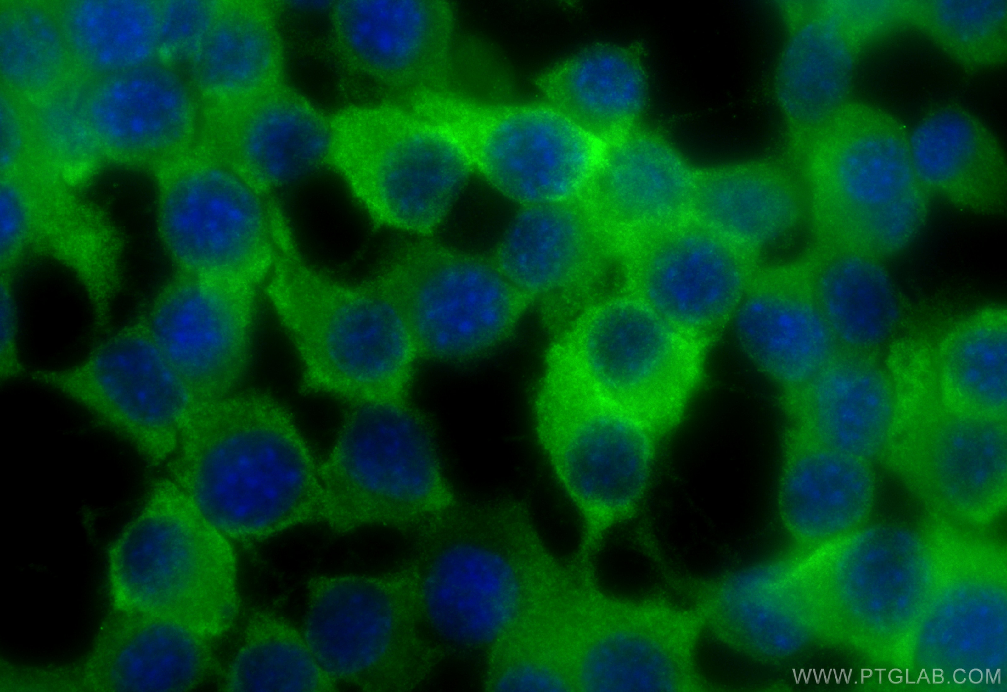 Immunofluorescent analysis of (-20°C Ethanol) fixed Neuro-2a cells using CoraLite® Plus 488 DNM1 antibody (CL488-68009, Clone: 1B2A11 ) at dilution of 1:200. Immunofluorescence (IF) / fluorescent staining of Neuro-2a cells using CoraLite® Plus 488-conjugated DNM1 Monoclonal anti (CL488-68009)