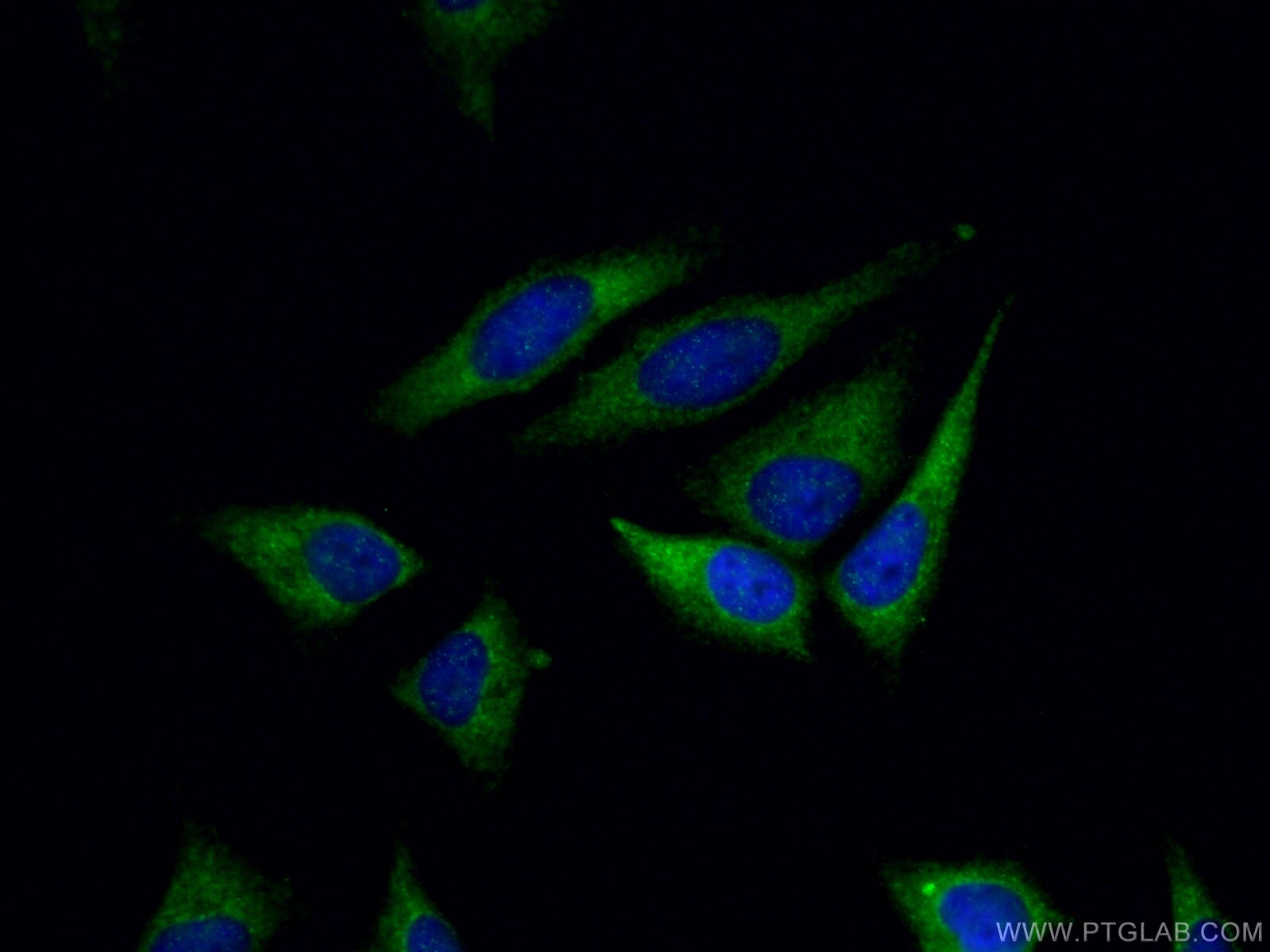 Immunofluorescence (IF) / fluorescent staining of HeLa cells using DRP1 (C-terminal) Polyclonal antibody (12957-1-AP)