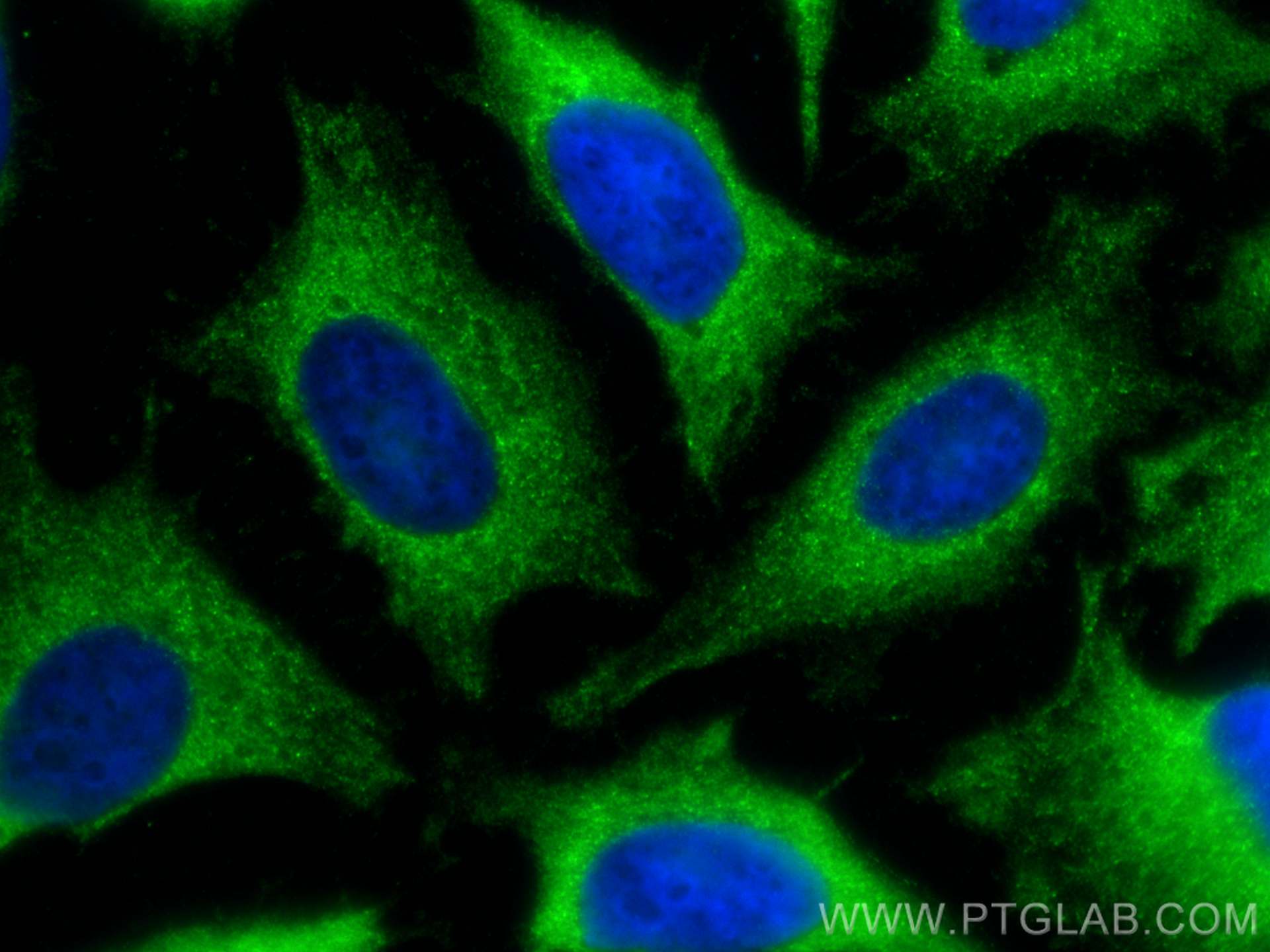 Immunofluorescence (IF) / fluorescent staining of HeLa cells using DRP1 (C-terminal) Polyclonal antibody (12957-1-AP)