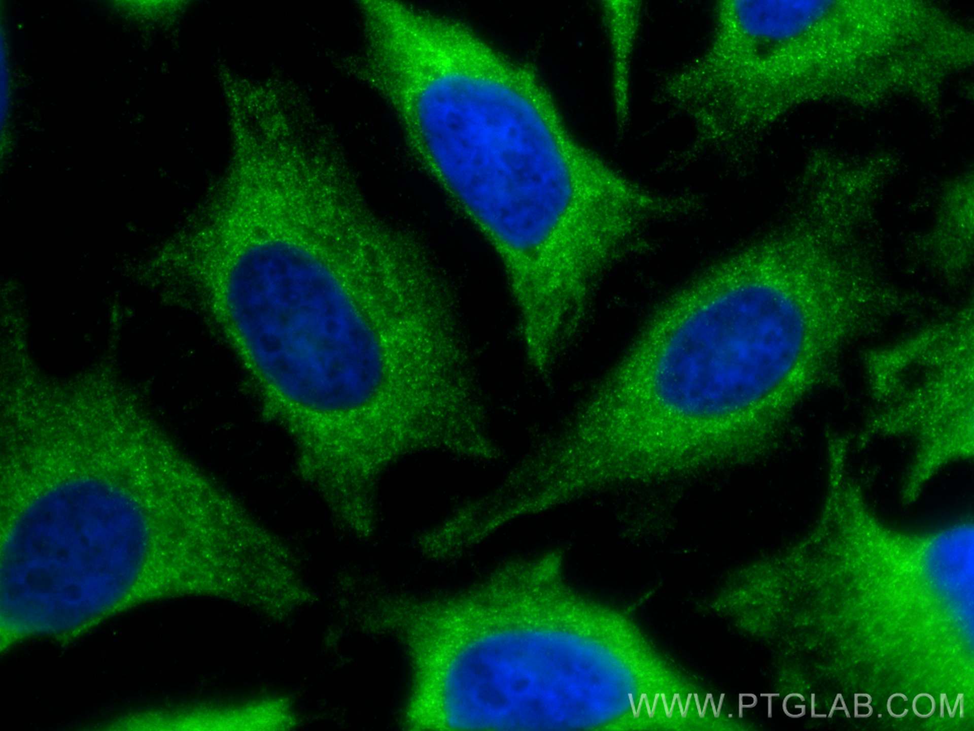 IF Staining of HeLa using 12957-1-AP