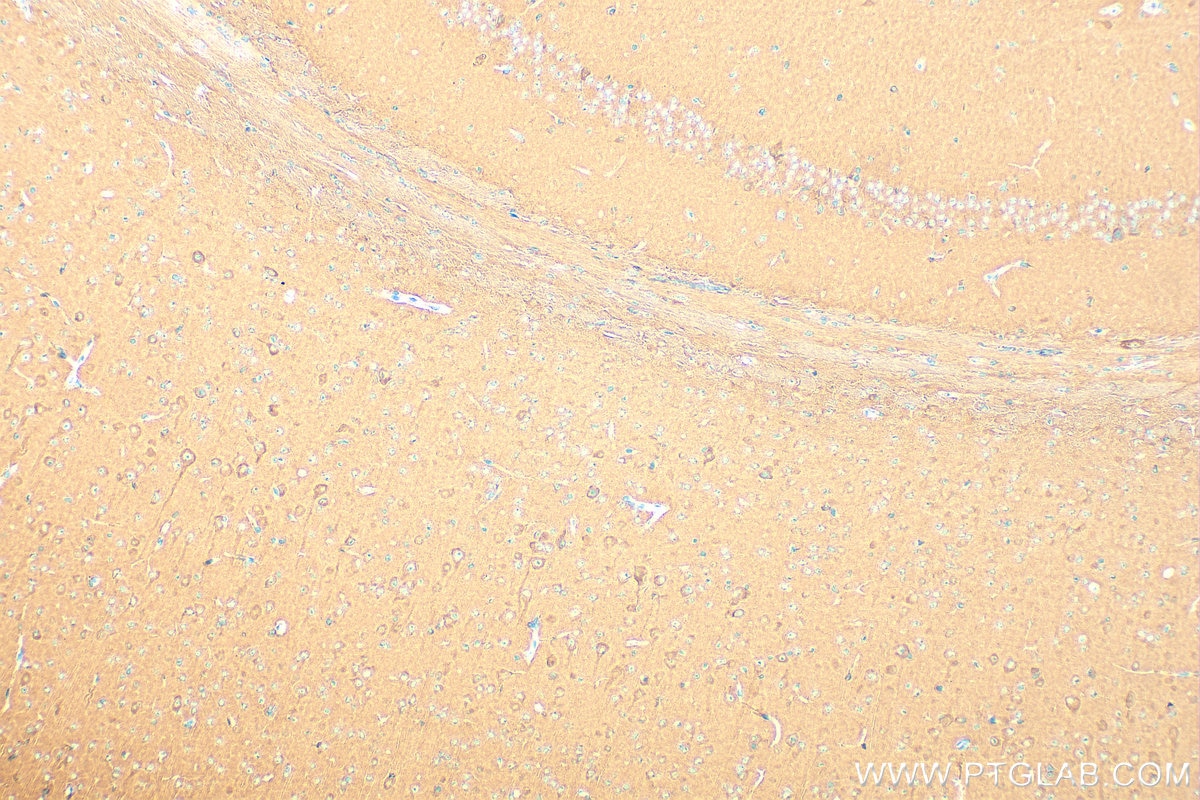 Immunohistochemical analysis of paraffin-embedded mouse brain tissue slide using 12957-1-AP (DRP1 (C-terminal) antibody) at dilution of 1:1000 (under 10x lens). Heat mediated antigen retrieval with Tris-EDTA buffer (pH 9.0). Immunohistochemistry (IHC) staining of mouse brain tissue using DRP1 (C-terminal) Polyclonal antibody (12957-1-AP)