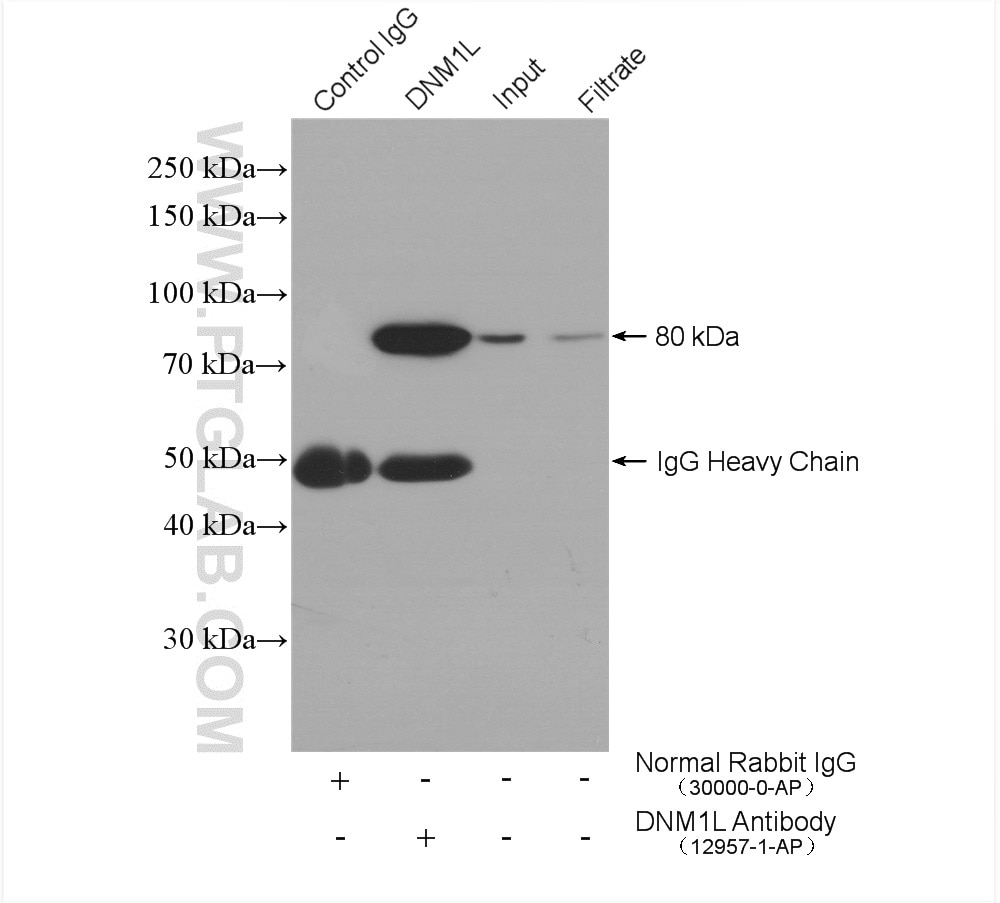 Immunoprecipitation (IP) experiment of mouse brain tissue using DRP1 (C-terminal) Polyclonal antibody (12957-1-AP)