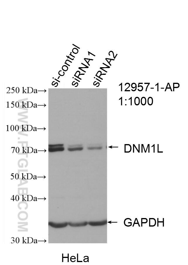 Western Blot (WB) analysis of HeLa cells using DRP1 (C-terminal) Polyclonal antibody (12957-1-AP)