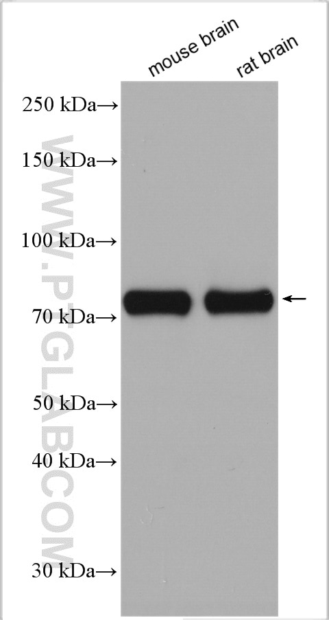 Western Blot (WB) analysis of various lysates using DRP1 (C-terminal) Polyclonal antibody (12957-1-AP)