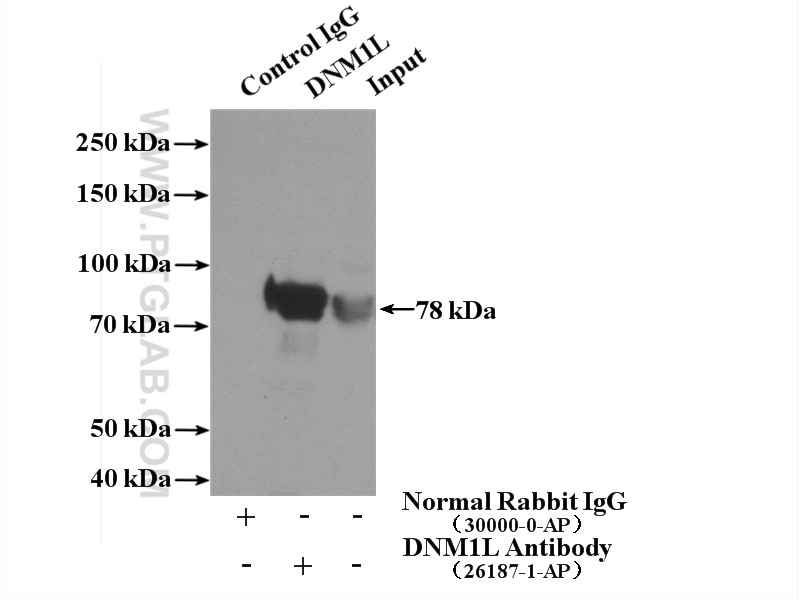 Immunoprecipitation (IP) experiment of mouse brain tissue using DRP1 (N-terminal) Polyclonal antibody (26187-1-AP)