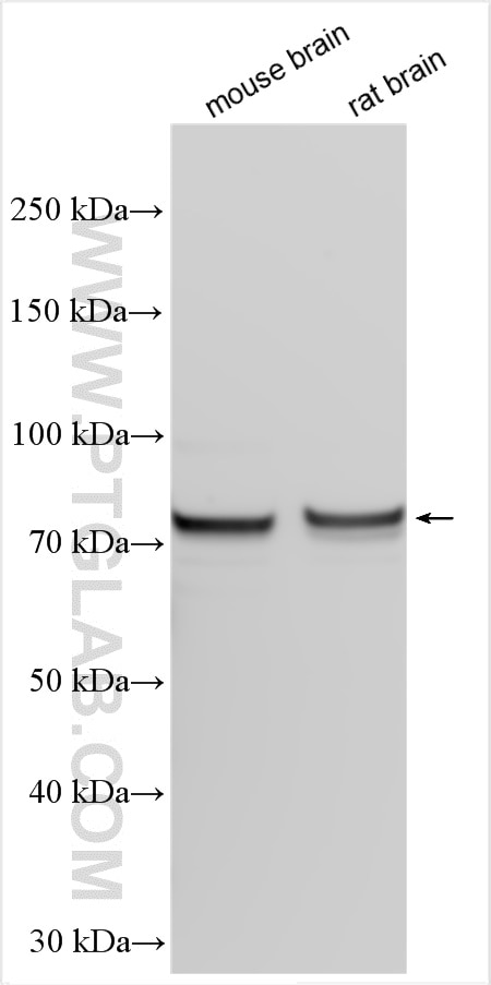 Western Blot (WB) analysis of various lysates using DRP1 (N-terminal) Polyclonal antibody (26187-1-AP)
