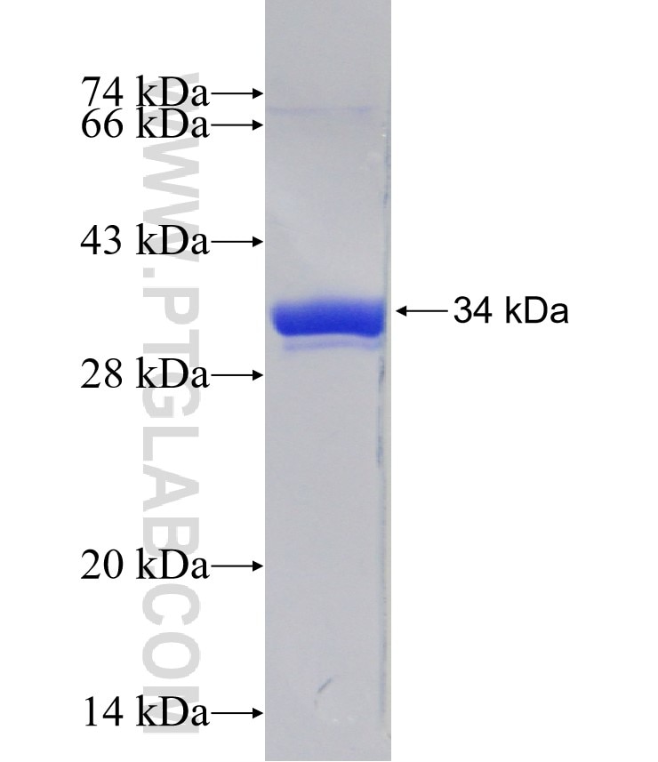 DNM1L,DLP1 fusion protein Ag24249 SDS-PAGE