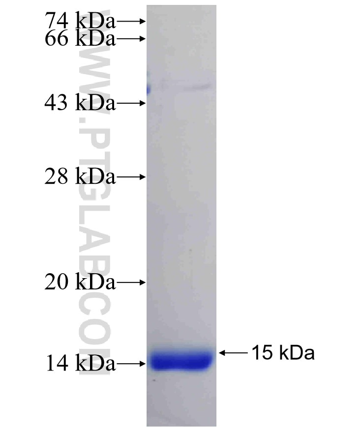 DNM1L,DLP1 fusion protein Ag24263 SDS-PAGE
