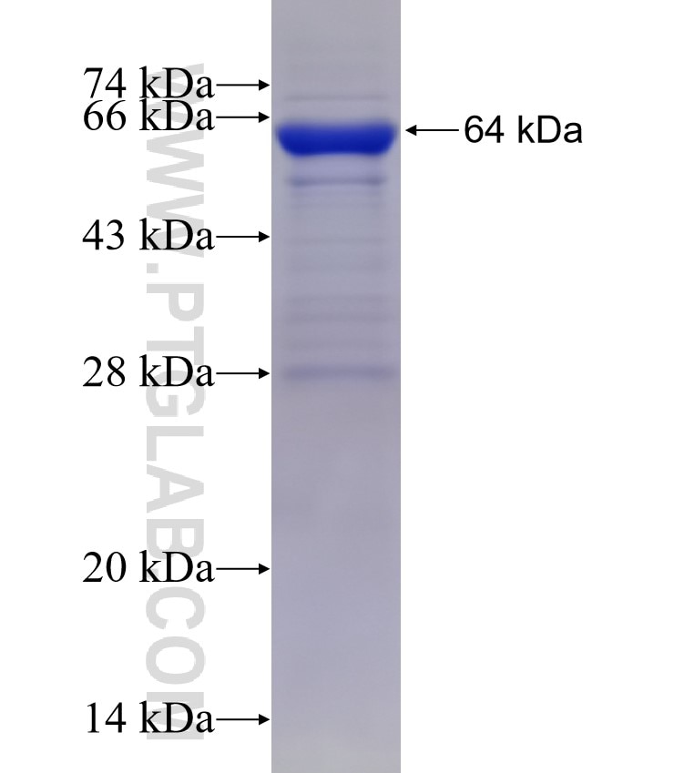 DNM1L,DLP1 fusion protein Ag3644 SDS-PAGE