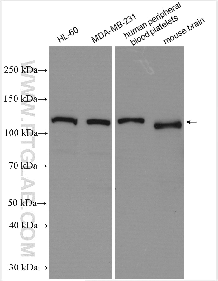 Western Blot (WB) analysis of various lysates using DNM2 Polyclonal antibody (14605-1-AP)