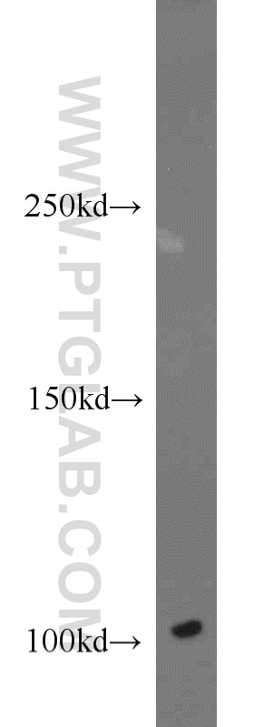 Western Blot (WB) analysis of HeLa cells using DNM2 Polyclonal antibody (14605-1-AP)