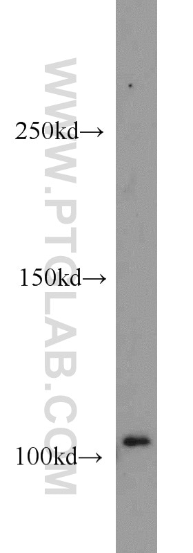 Western Blot (WB) analysis of Jurkat cells using DNM2 Polyclonal antibody (14605-1-AP)