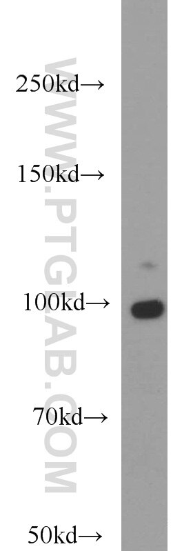 DNM2 Polyclonal antibody