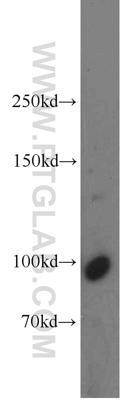 Western Blot (WB) analysis of NIH/3T3 cells using DNM2 Polyclonal antibody (14605-1-AP)