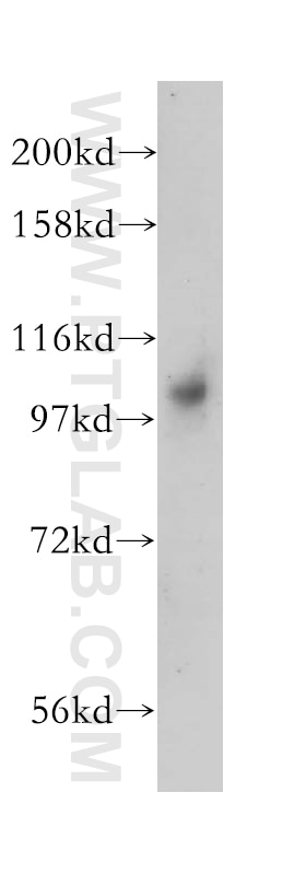 Western Blot (WB) analysis of human brain tissue using DNM2 Polyclonal antibody (14605-1-AP)