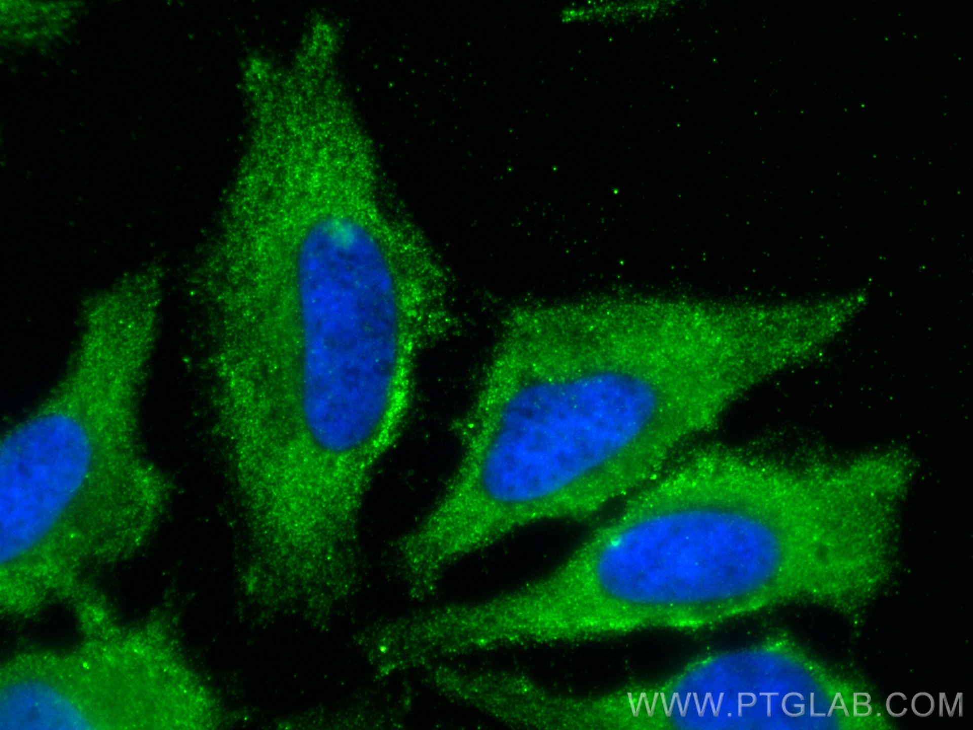 Immunofluorescence (IF) / fluorescent staining of HeLa cells using DNM2 Monoclonal antibody (68209-1-Ig)