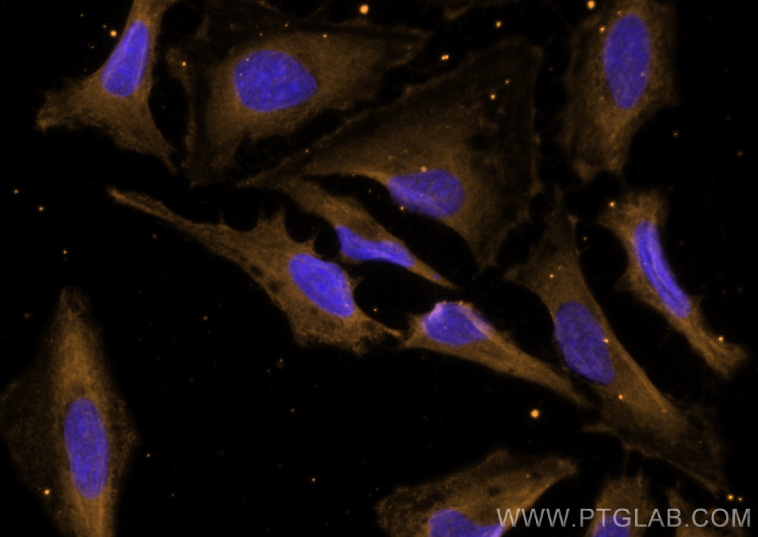 IF Staining of HeLa using CL555-68209