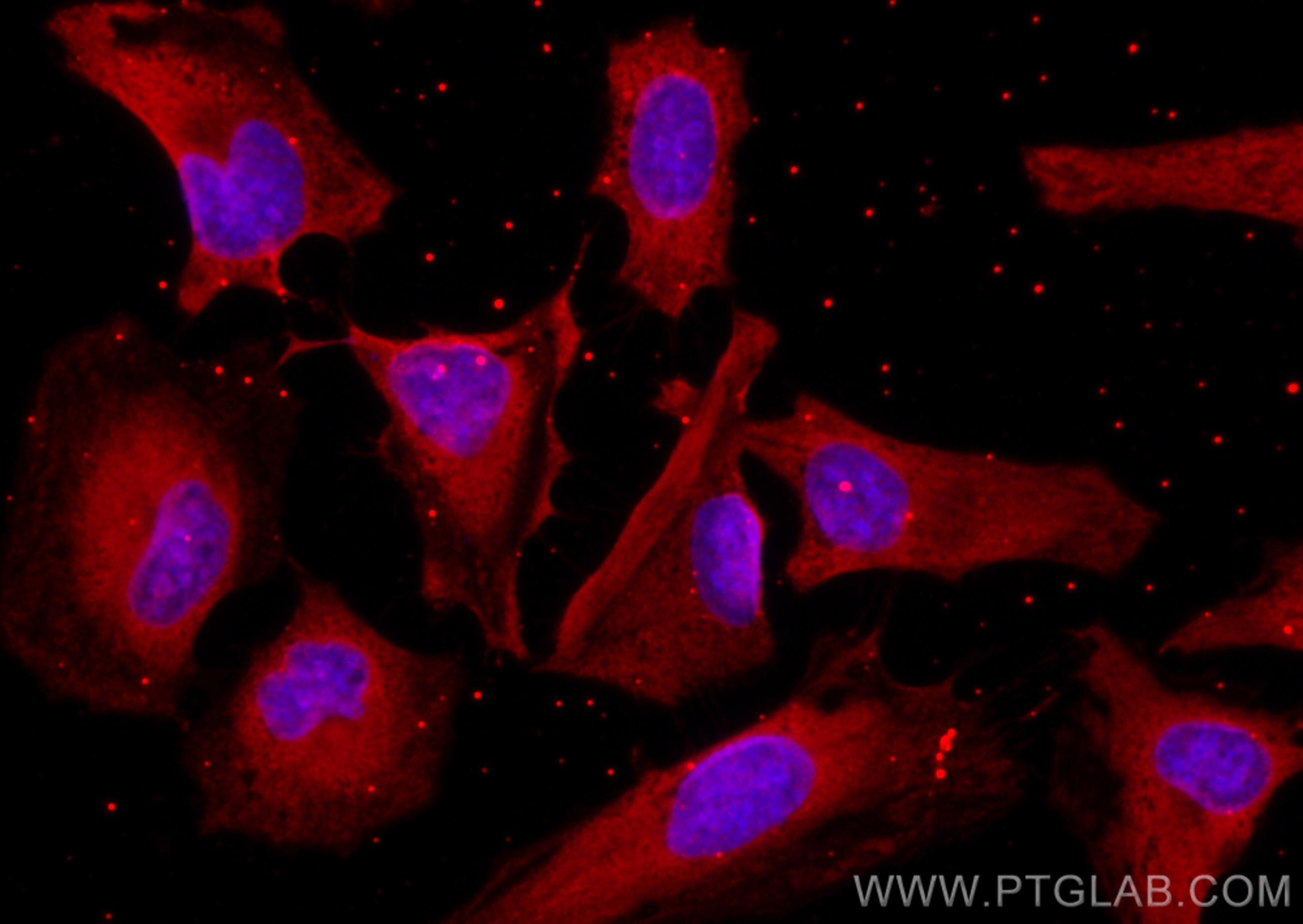 Immunofluorescence (IF) / fluorescent staining of HeLa cells using CoraLite®594-conjugated DNM2 Monoclonal antibody (CL594-68209)