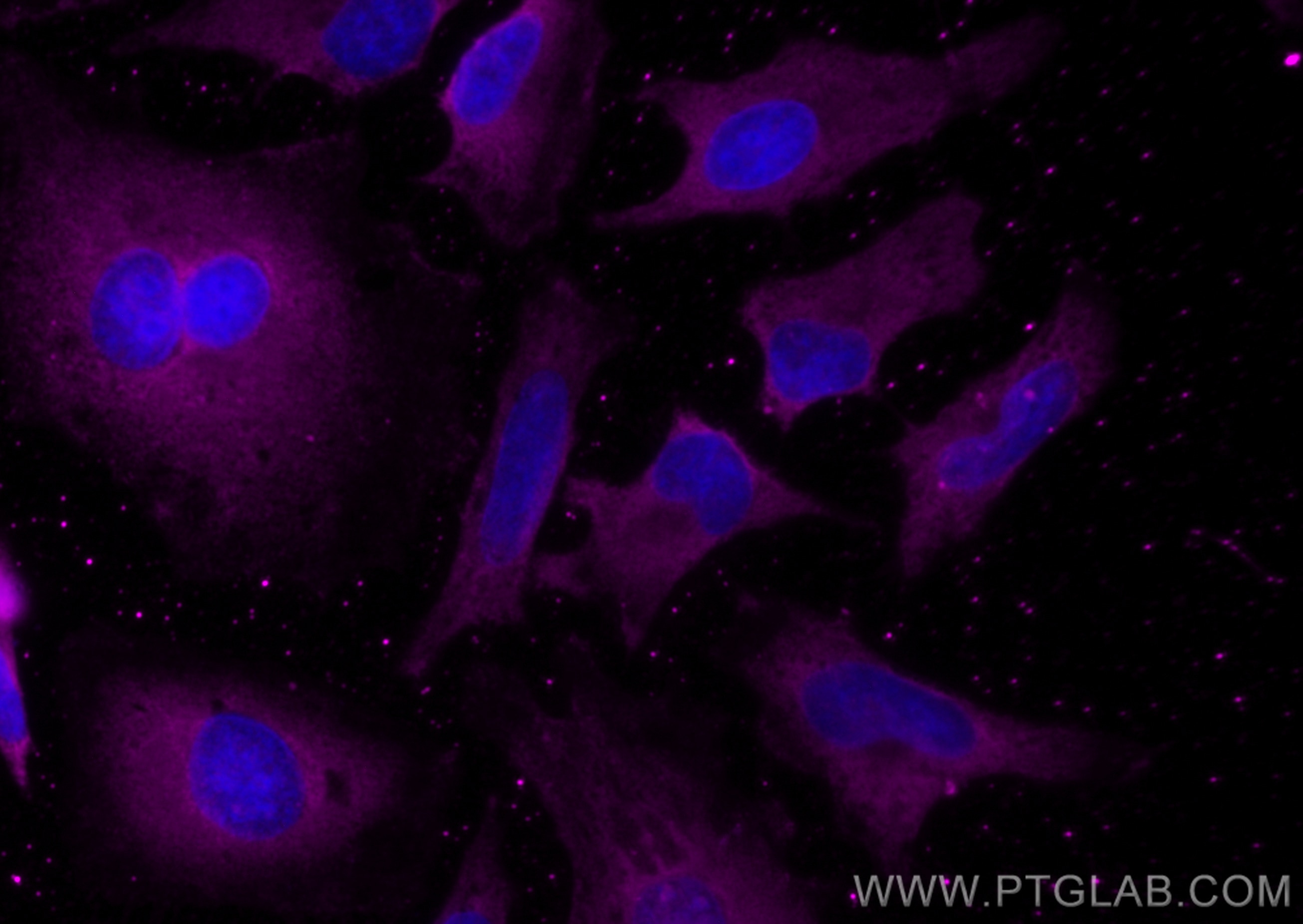 Immunofluorescence (IF) / fluorescent staining of HeLa cells using CoraLite® Plus 647-conjugated DNM2 Monoclonal anti (CL647-68209)