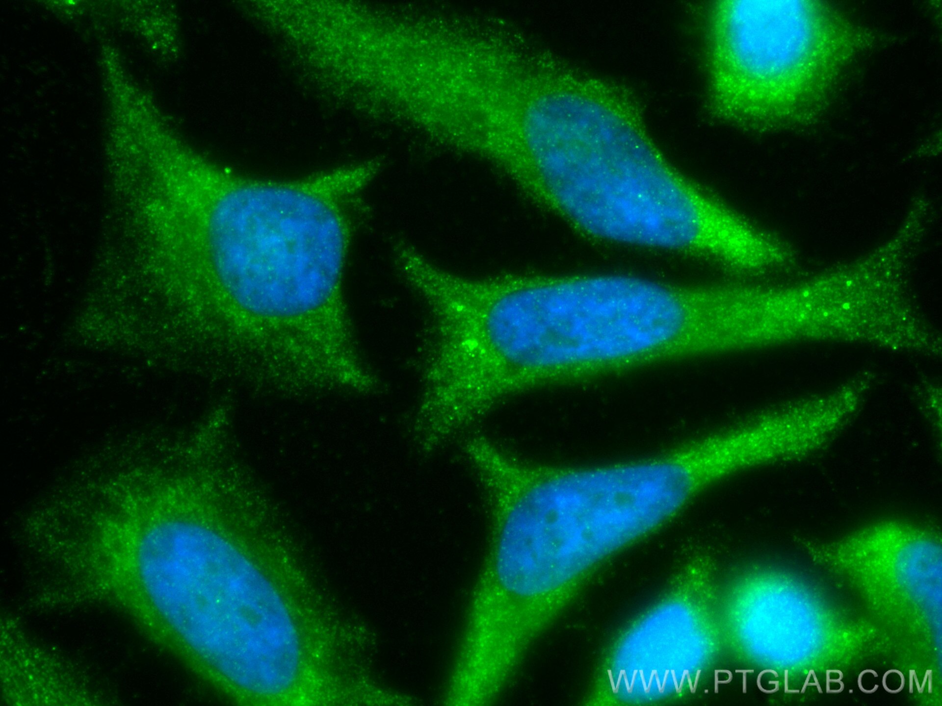 Immunofluorescence (IF) / fluorescent staining of HeLa cells using DNM3 Polyclonal antibody (14737-1-AP)