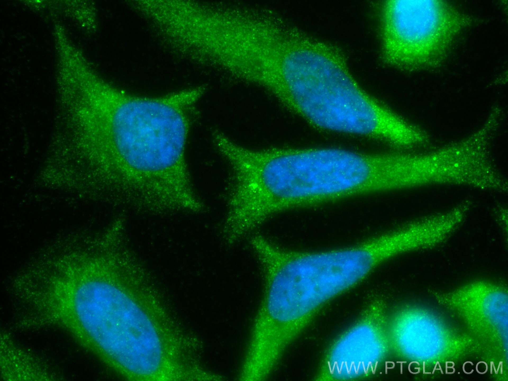 IF Staining of HeLa using 14737-1-AP