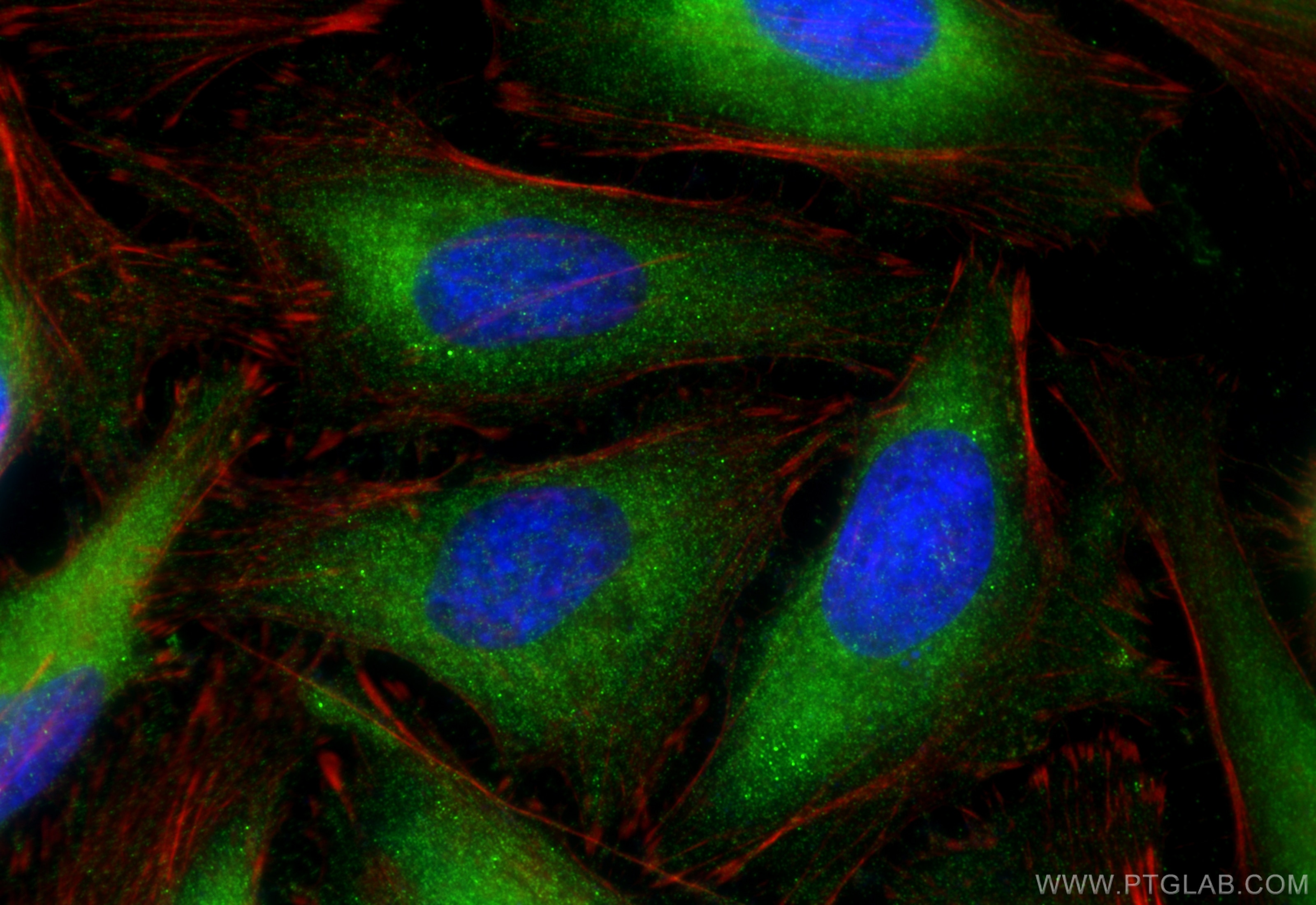Immunofluorescence (IF) / fluorescent staining of HeLa cells using DNM3 Polyclonal antibody (14737-1-AP)