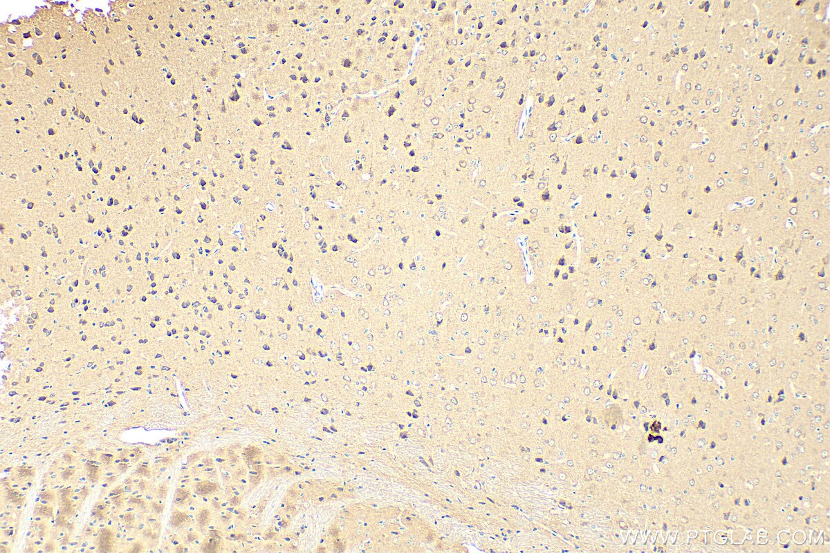 Immunohistochemistry (IHC) staining of mouse brain tissue using DNM3 Polyclonal antibody (14737-1-AP)