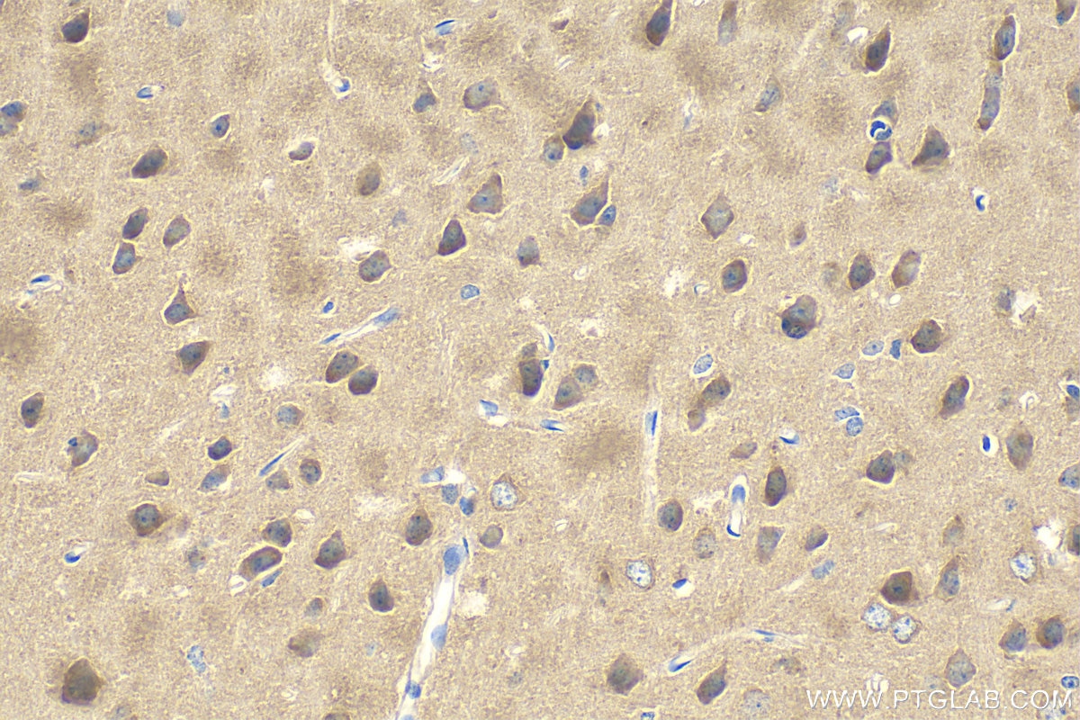 Immunohistochemistry (IHC) staining of mouse brain tissue using DNM3 Polyclonal antibody (14737-1-AP)