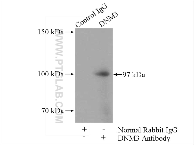 Immunoprecipitation (IP) experiment of mouse brain tissue using DNM3 Polyclonal antibody (14737-1-AP)