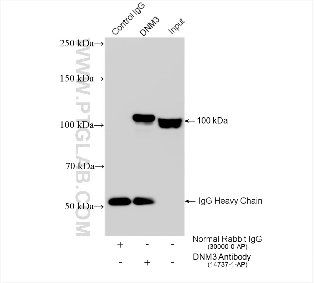 Immunoprecipitation (IP) experiment of mouse brain tissue using DNM3 Polyclonal antibody (14737-1-AP)
