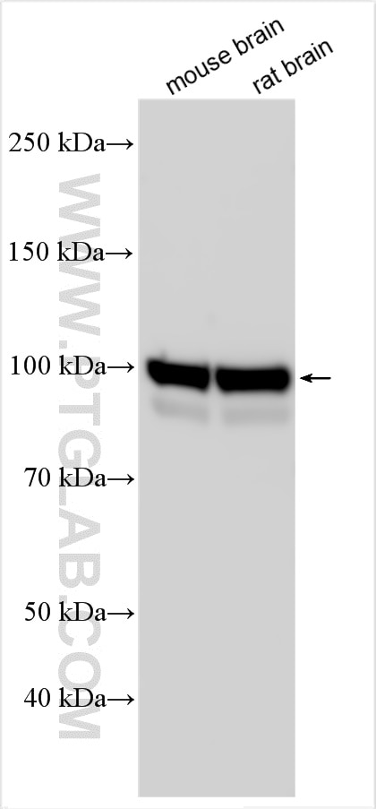 Western Blot (WB) analysis of various lysates using DNM3 Polyclonal antibody (14737-1-AP)