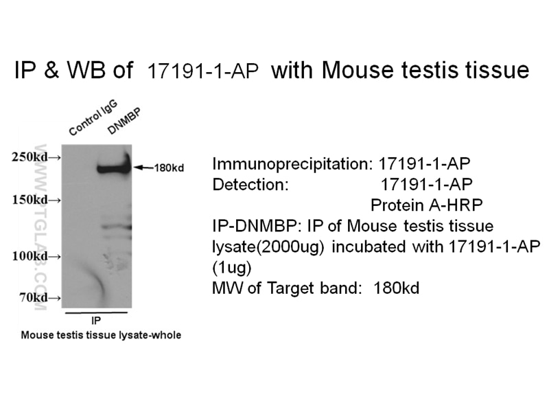 Immunoprecipitation (IP) experiment using DNMBP Polyclonal antibody (17191-1-AP)