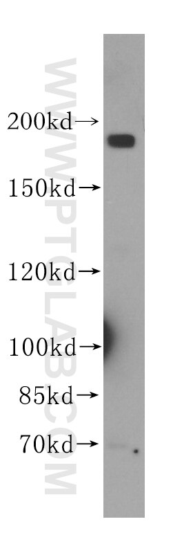 Western Blot (WB) analysis of mouse brain tissue using DNMBP Polyclonal antibody (17191-1-AP)