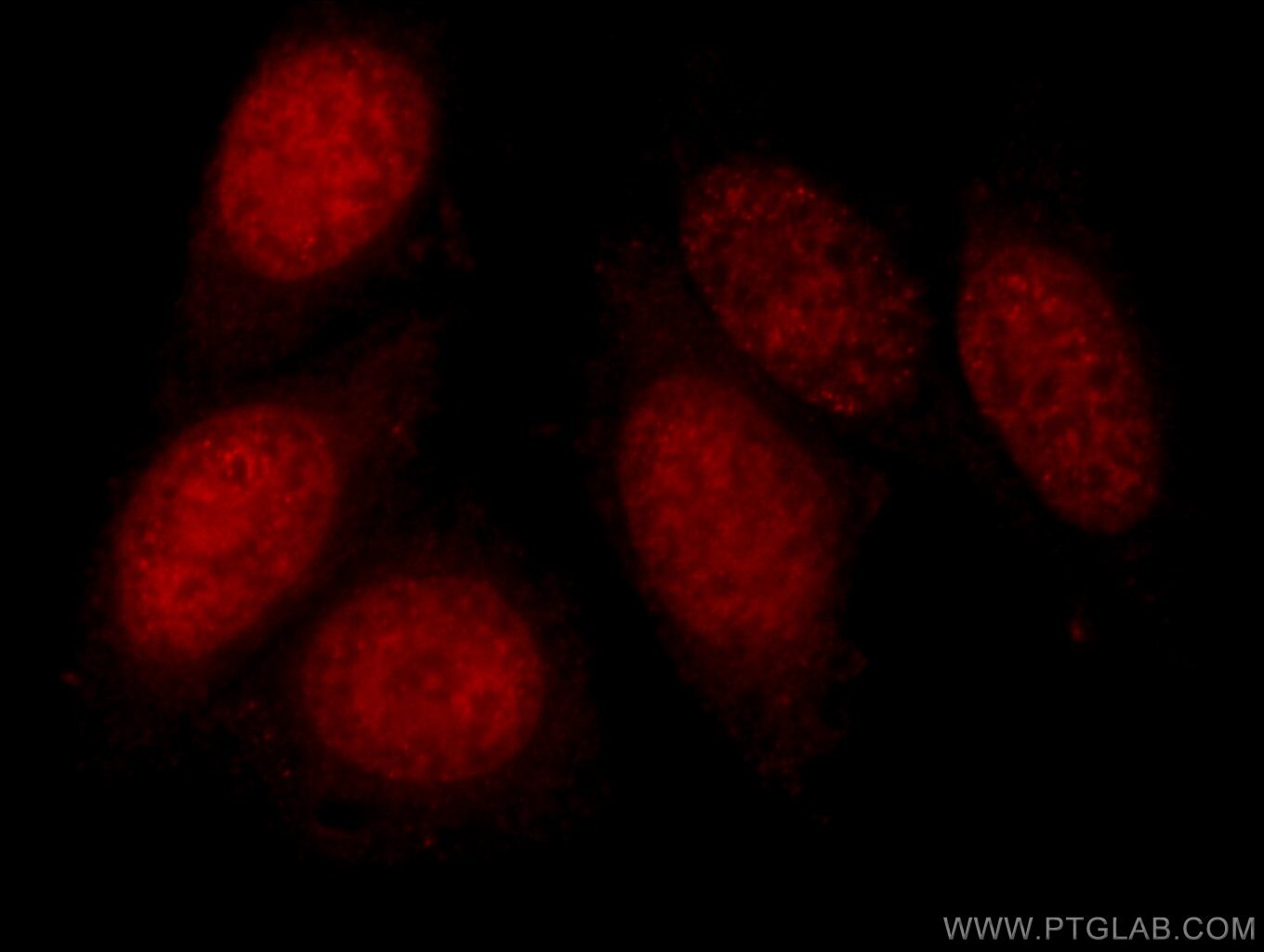 DNMT1 Polyclonal antibody