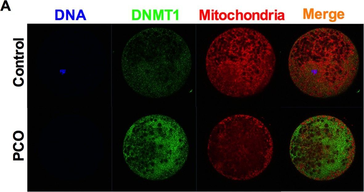 DNMT1