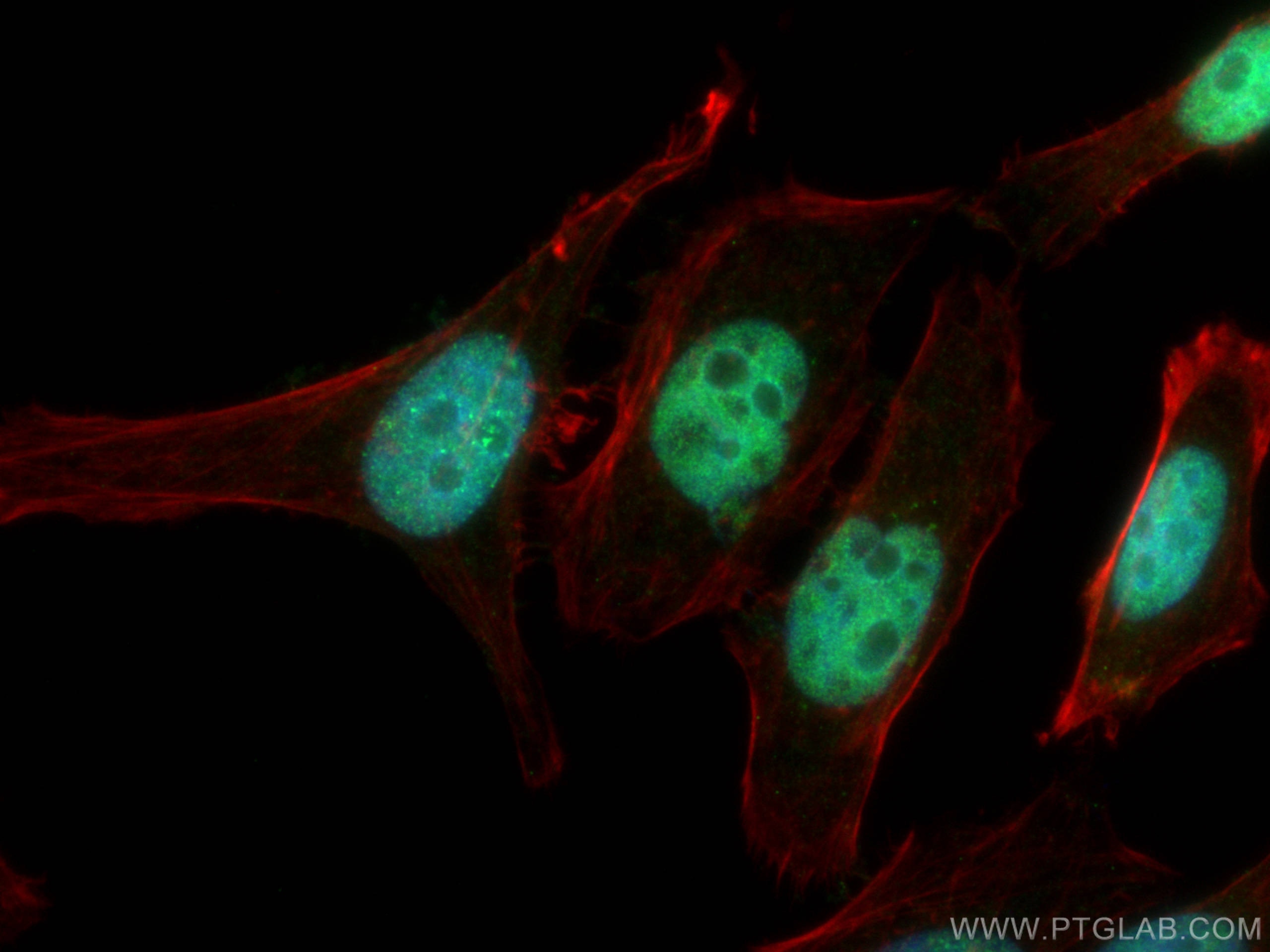 Immunofluorescence (IF) / fluorescent staining of HepG2 cells using DNMT1 Polyclonal antibody (24206-1-AP)