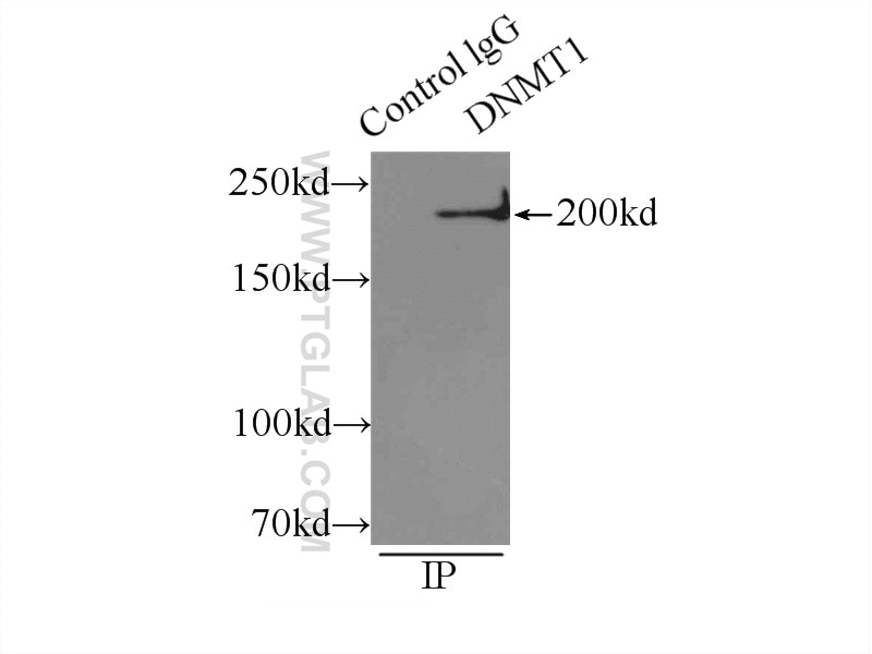 DNMT1 Polyclonal antibody