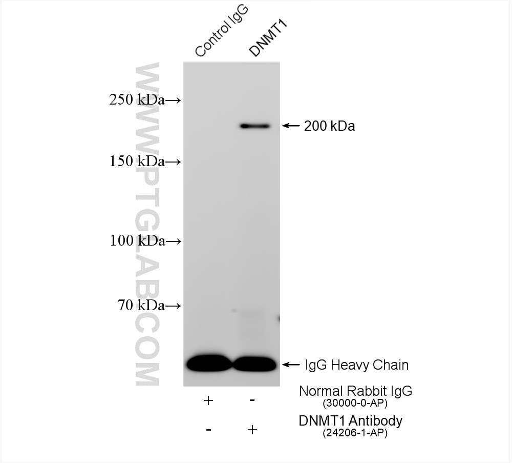 Immunoprecipitation (IP) experiment of HEK-293 cells using DNMT1 Polyclonal antibody (24206-1-AP)