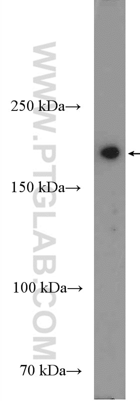 Western Blot (WB) analysis of C6 cells using DNMT1 Polyclonal antibody (24206-1-AP)